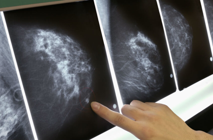  Augusta. Mammografia, dopo il guasto un piano di azzeramento delle attese