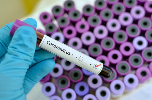  Coronavirus, il bollettino: 65 nuovi positivi in Sicilia, 3 in provincia di Siracusa