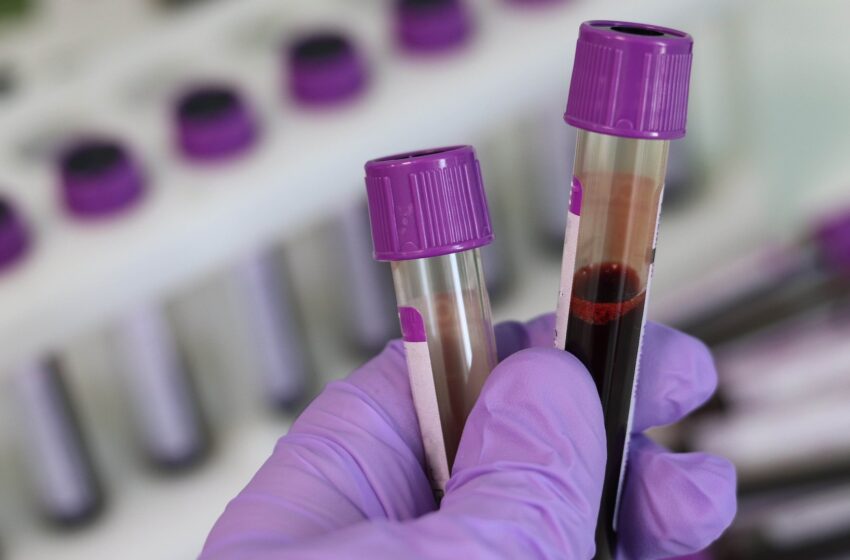 Coronavirus, il bollettino: 918 nuovi positivi in Sicilia, +39 in provincia di Siracusa